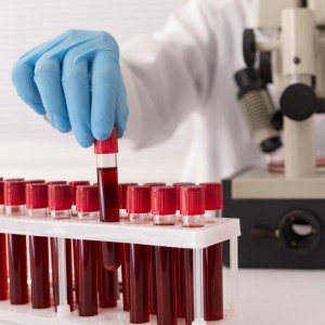 20 биохимических показателей крови
